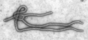 Ebola_Virus_TEM_PHIL_1832_lores-1
